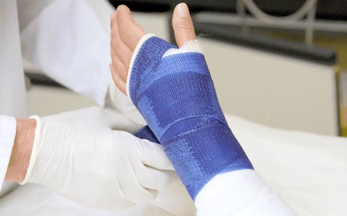 A doctor examining a patient's injured arm wrapped in a blue cast, representing evidence for a Premises Liability Injury Lawyer.